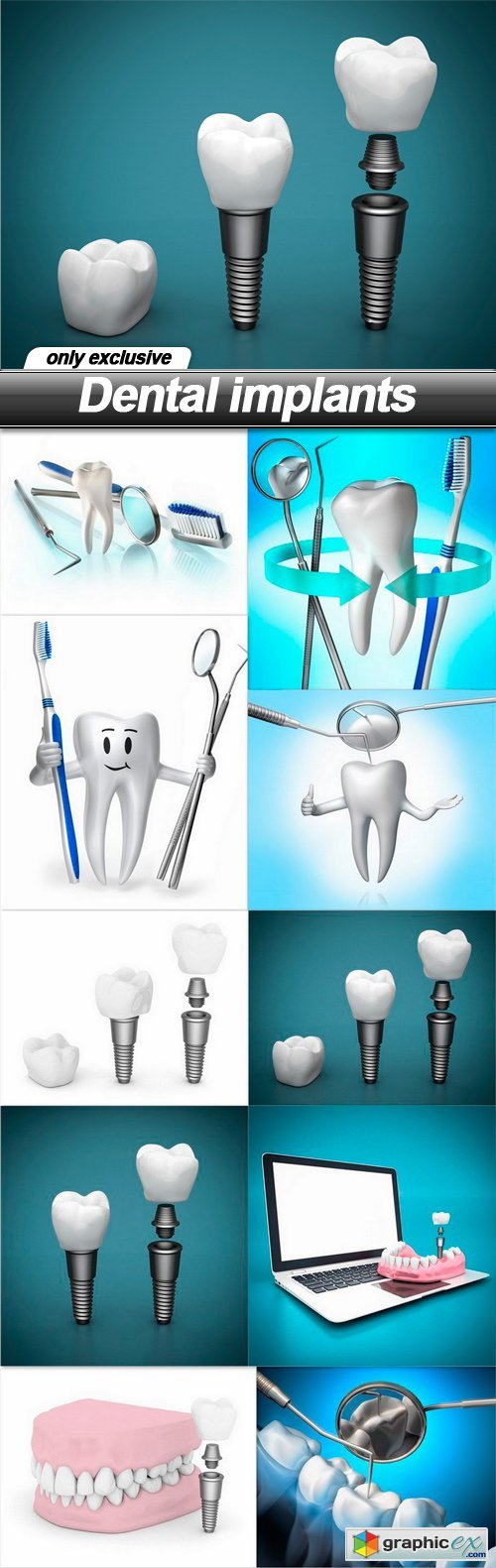 Dental implants - 10 UHQ JPEG