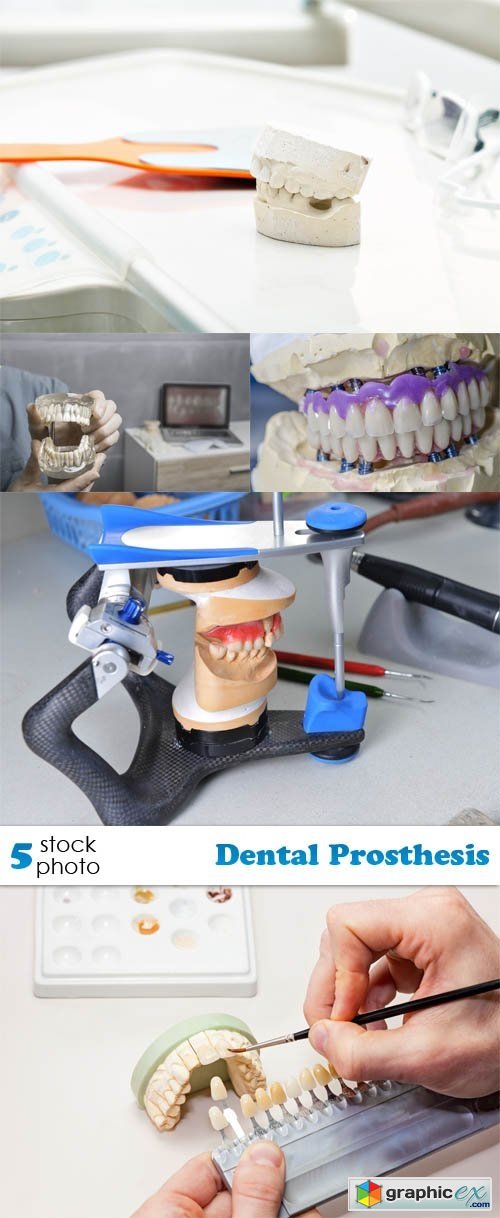 Photos - Dental Prosthesis