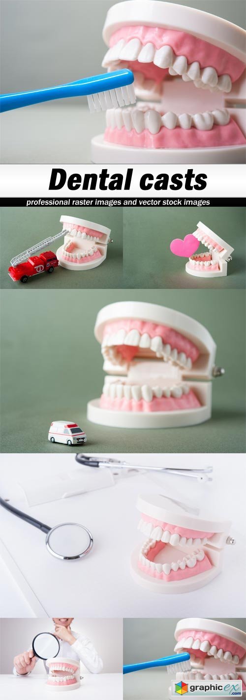 Dental casts - 6 UHQ JPEG