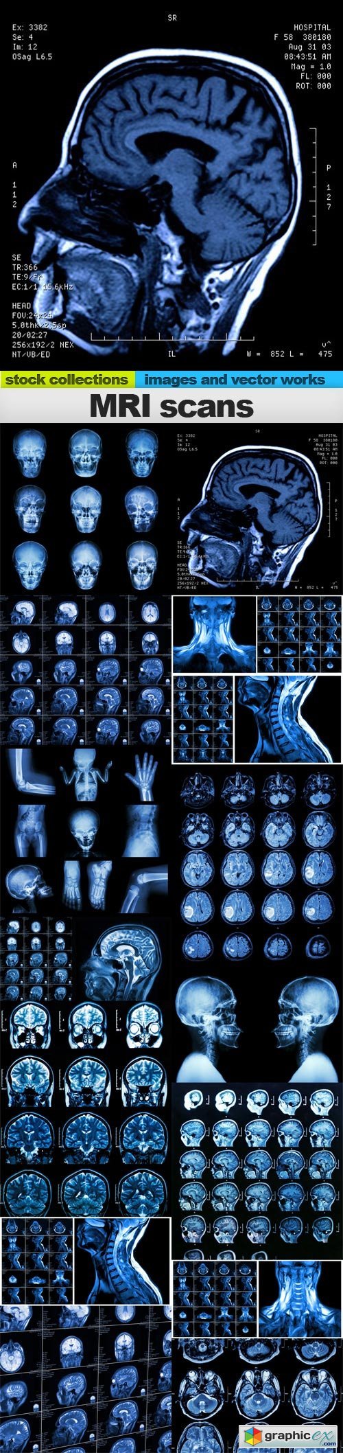 MRI scans, 15 x UHQ JPEG