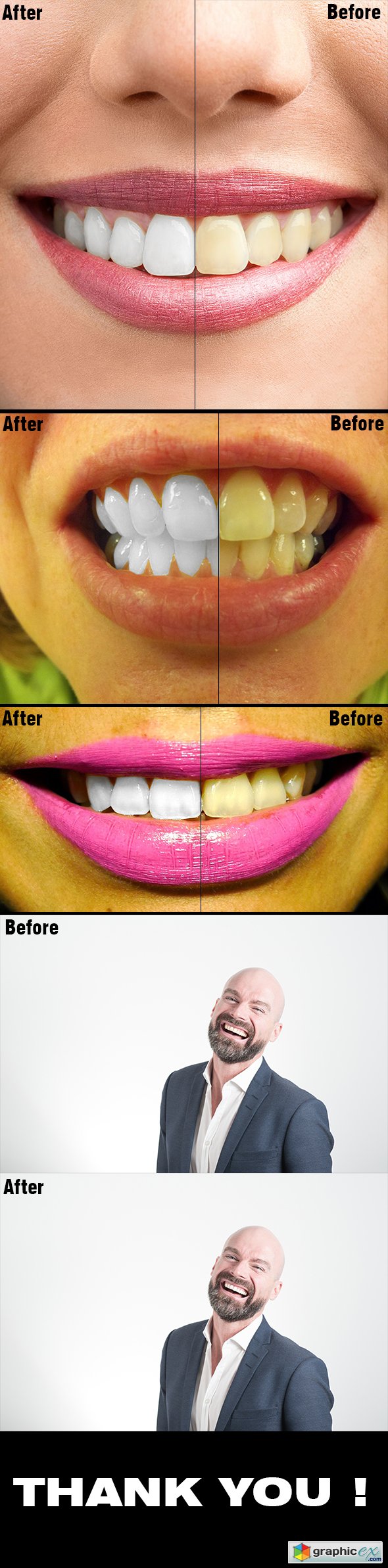 Teeth Whitening PS Action Photo Effects