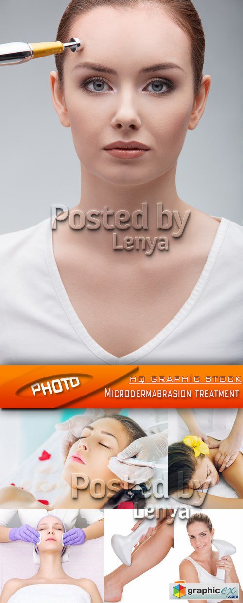 Stock Photo - Microdermabrasion treatment 01