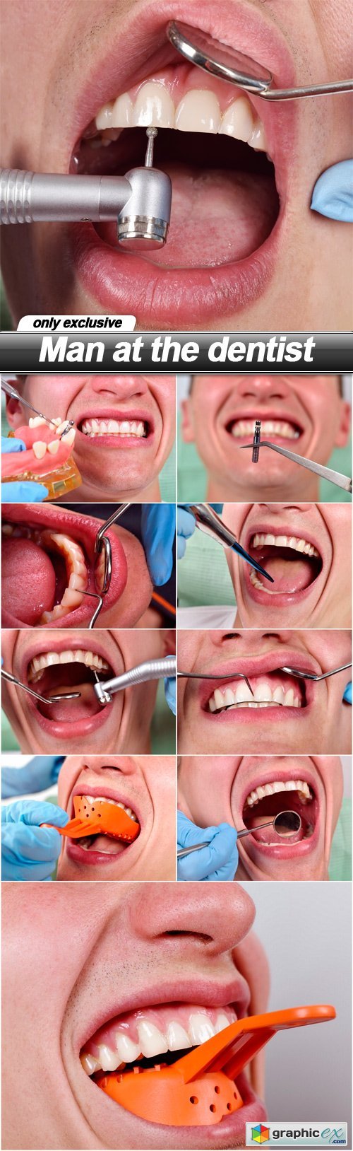 Man at the dentist - 10 UHQ JPEG