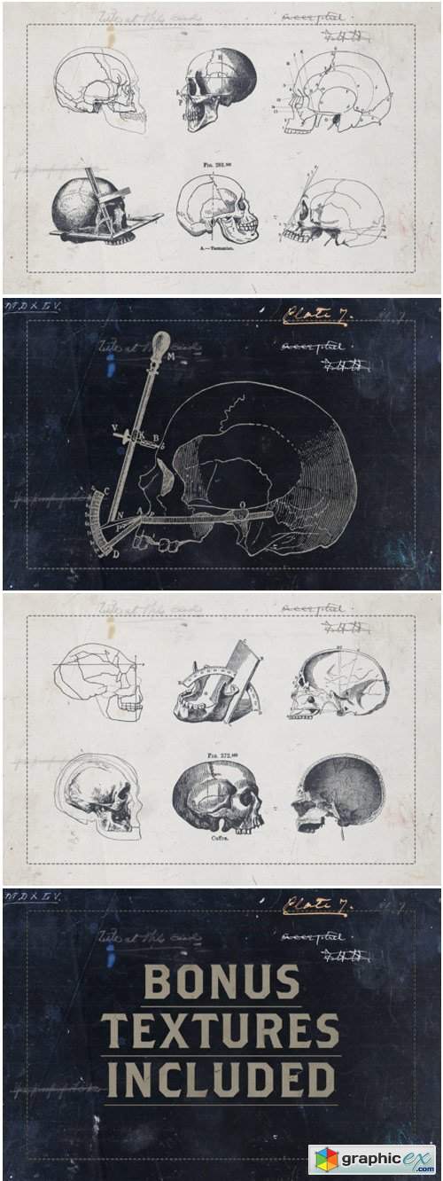 Craniometry